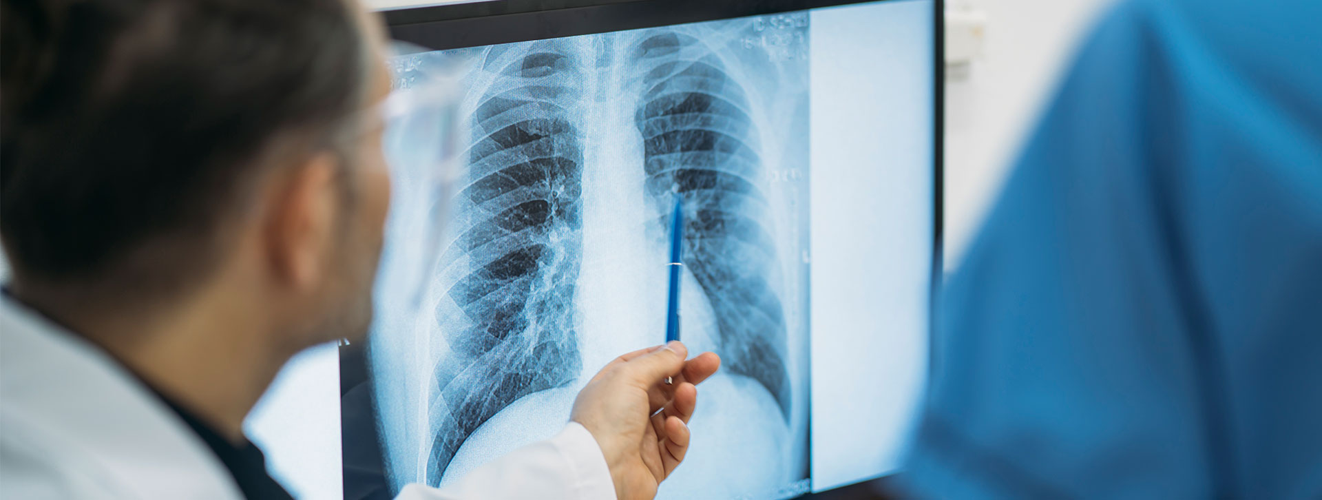 Close up of doctors analysing radiological chest x-ray film.