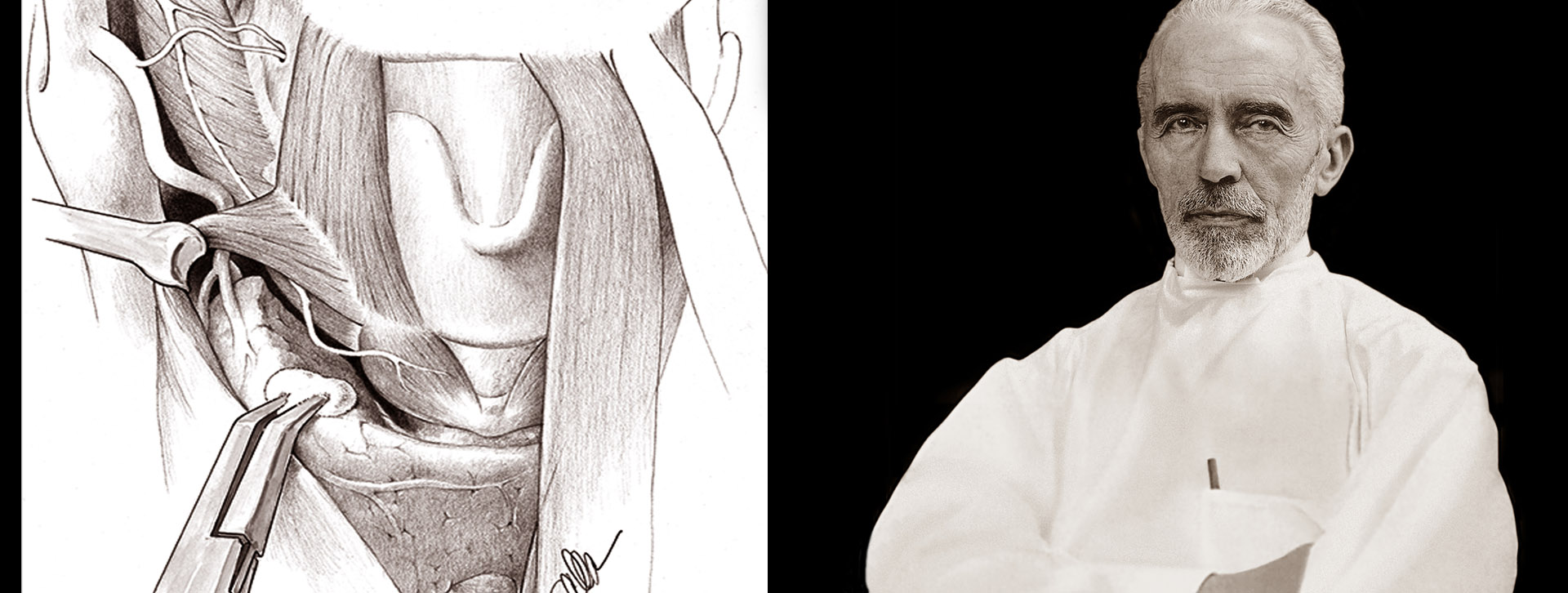 Black and white image of thyroid anatomy on the left and Dr. Kocher on the right.