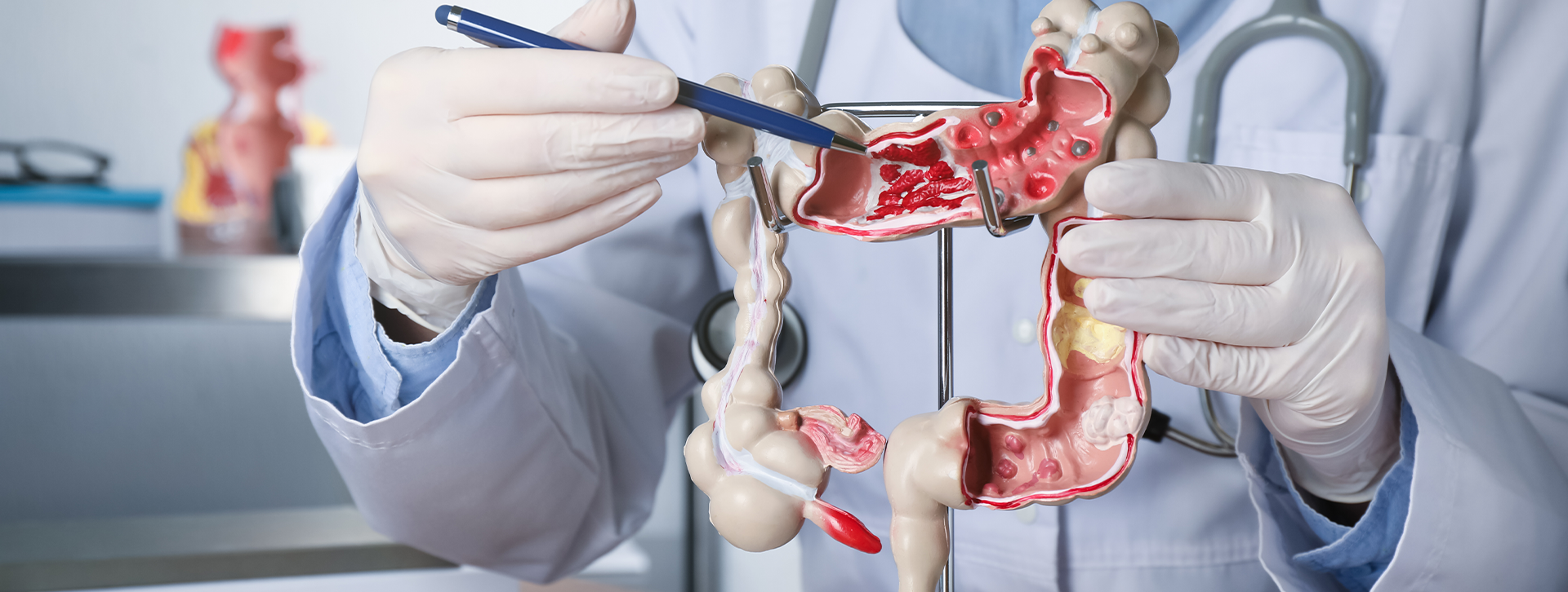 Gastroenterologist showing human colon model at table in clinic, closeup.