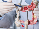 Gastroenterologist showing human colon model at table in clinic, closeup.