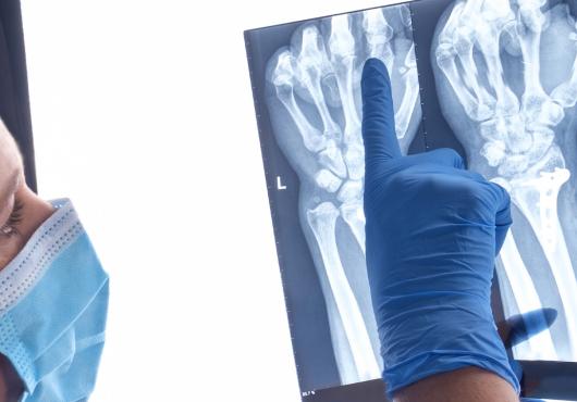 Doctor pointing at x-ray of hand. 