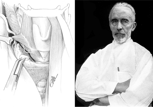 Medical Drawing of the thyroid and black and white photo of Dr. Kocher.