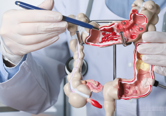 Gastroenterologist showing human colon model at table in clinic, closeup.