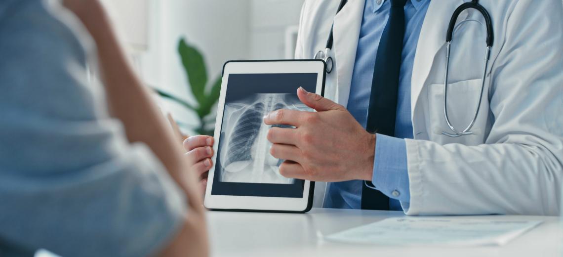 doctor showing xray
