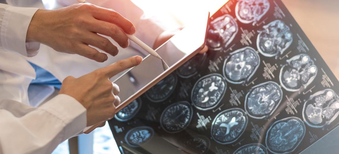 MRI digital x-ray of brain with team radiologist doctor oncology working together in clinic hospital.