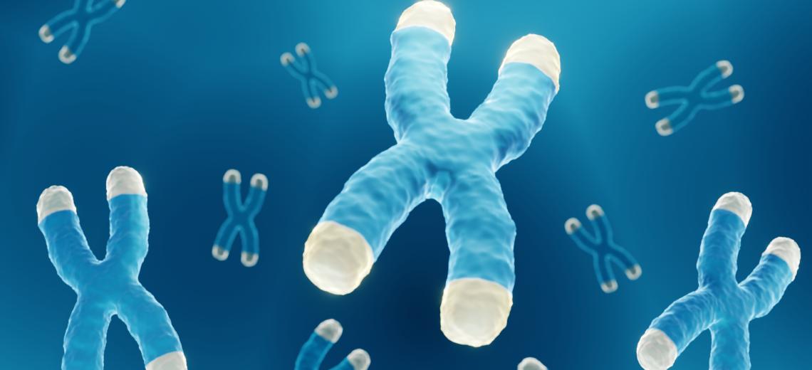 down syndrome chromosome.