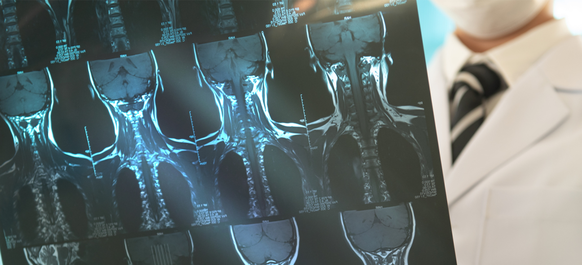 doctor holding X ray of head and neck.